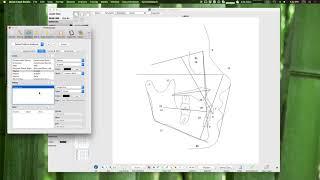 Quick Ceph Studio - Analyses & Creating a Custom Analysis