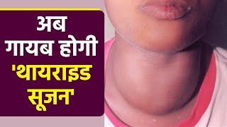 Thyroid Swelling Treatment: थायराइड में सूजन ठीक करने का जबरदस्त उपाय | Boldsky *Health