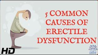 5 COMMON CAUSES OF ERECTILE DYSFUNCTION