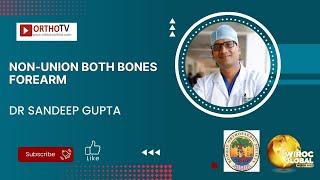 Non-Union both Bones Forearm - Dr Sandeep Gupta