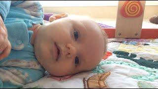 Chapter 3: Counterpressure Strategies for Awake Time (Infant Repositioning for Plagiocephaly)