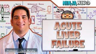 Acute Liver Failure | Clinical Medicine
