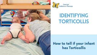 How to Tell if Your Baby Has Torticollis