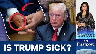 Mysterious Bruise Appears on Trump's ​Hand. Where Did it Come From? | Vantage with Palki Sharma