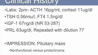 Clinical History - Hyponatremia | UCLA Pituitary Tumor Program