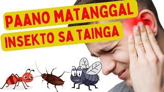  Paano matanggal ang INSEKTO sa TAINGA? |Effective na mga paraan sa pagtannggal ng insekto sa TENGA