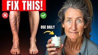 "20 YEARS LEG PAIN GONE!!" Varicose Veins Treatment That ACTUALLY Works! | Barbara O'Neill