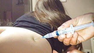 IM Intramuscular injection Push in the Buttocks ketolac & paracetamol & Dexamethasone (ventrogluteal