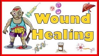 Wound Healing: Mechanism, Types, Primary, Secondary & Tertiary intention of healing & Complications