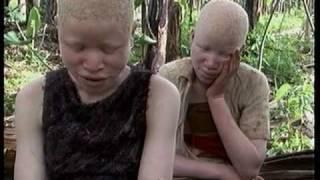 Deadly Hunt: Albinos in Tanzania