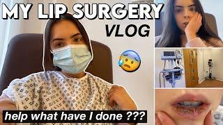 MY FIRST OPERATION VLOG | THE WORST WEEK ever after getting lip surgery, my experience & recovery ??