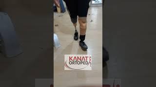 HAFİF AKTİF VAKUM PROTEZ-VAKUMLU PROTEZ-DİZALTI PROTEZ-PROSTHETİC LEG-PROSTHETİC FOOT-SİLİKON PROTEZ