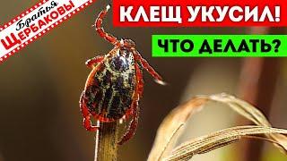 КЛЕЩ УКУСИЛ… Что делать? ТРИ лучших СПОСОБА спасения!