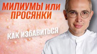 МИЛИУМЫ или ПРОСЯНКИ как избавиться в домашних условиях #подкожники #просянки