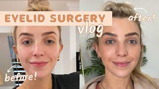 I HAD EYELID SURGERY/ Raw and real/ Weekly VLOG + Recover with me!