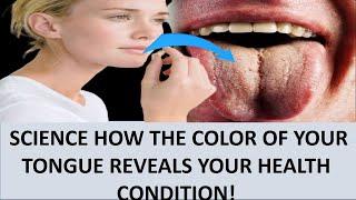 SCIENCE HOW THE COLOR OF YOUR TONGUE REVEALS YOUR HEALTH CONDITION!