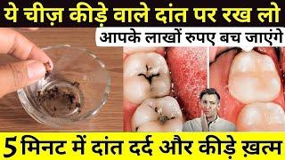 ये चीज़ 2 मिनट में दांतों का दर्द खत्म कर कीड़े ख़त्म कर देगी | Dant Dard Ka Fori ilaj | Teeth Solution