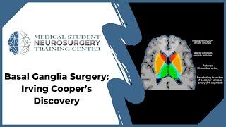 Basal Ganglia Surgery: Irving Cooper’s Discovery