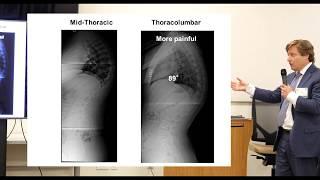 2019 Power Over Scoliosis Event - Scheuermann's Kyphosis - Speaker Session 1