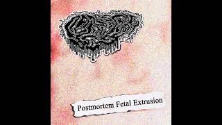 Fetal Deformity - Postmortem Fetal Extrusion FULL ALBUM 2022 (GORE GRIND)