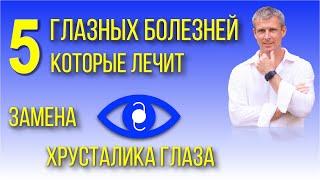 Что лечит операция на глазах по замене хрусталика глаза - не только катаракта