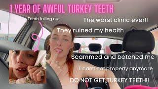 AWFUL Turkey teeth update - STAY AWAY FROM MONO CLINIC!!!