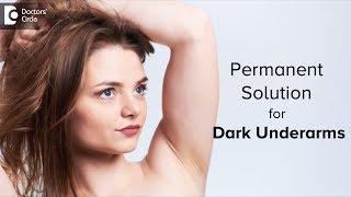 What to do about Dark Underarms? What is the reason for this? - Dr. Divya Sharma | Doctors' Circle