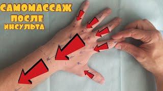 самомассаж кисти после инсульта