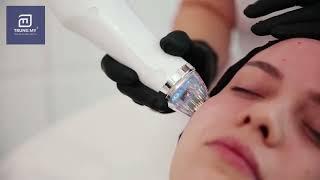 SECRET DUO - Thiết bị spa laser và vi kim cao cấp hàng đầu thế giới