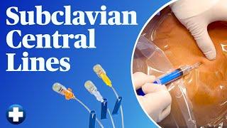 Subclavian Central Lines (Easy and Safe Landmark Method!)