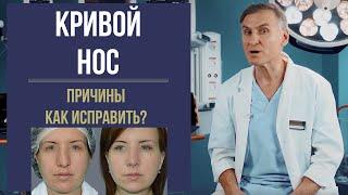 КРИВОЙ НОС  КРИВАЯ ПЕРЕГОРОДКА НОСА: КАК ВЫРОВНЯТЬ?