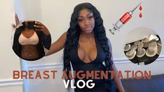 BOOB VLOG Breast Augmentation Recovery (VERY GRAPHIC )