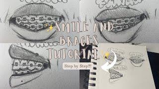 How To Draw Smile\ Braces || Step by Step (Beginner Friendly)