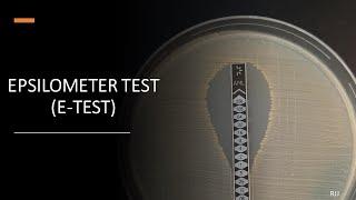 E-Test (Epsilometer Test)