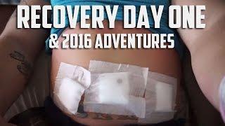 Hernia Recovery Day One & 2016 Adventure footage