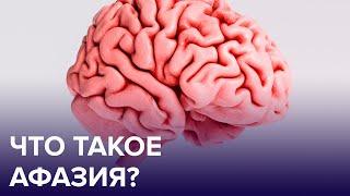 Что такое АФАЗИЯ? | Доктор 24