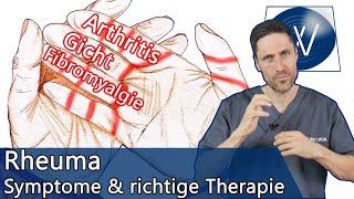 Rheuma sofort erkennen: Was ist Rheuma & welche Arten gibt es? Was man gegen Gelenkschmerzen tut!