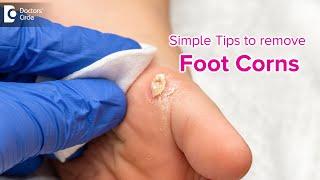 Simple tips to get rid of Foot Corn | Causes, Symptoms, Treatment-Dr. Rasya Dixit | Doctors' Circle