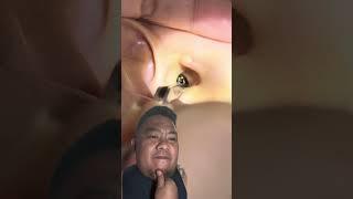 Ear Cleaning - very satisfying