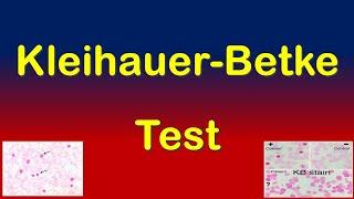 Kleihauer-Betke Test | How to Detect Fetal Maternal Hemorrhage?