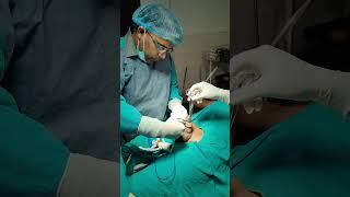 zsr circumcision -surgical vedio demonstration