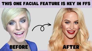 Gigi Gorgeous's FFS Surgeon Explains What Makes the Face Look Feminine