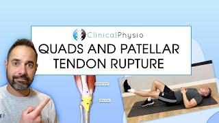 Quadriceps And Patella Tendon Rupture | Expert Physio Review