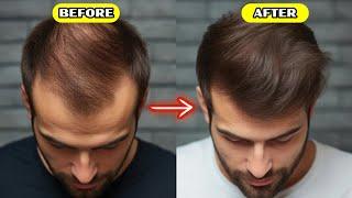 6 Natural Remedies To Prevent Hair Loss |How To Prevent Hair Loss Naturally - 6 Important Tips