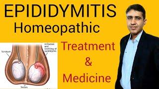 Epididymitis Symptoms,Causes and Treatment |Homeopathic medicine| Testicular Pain |Dr.Ramdeo Lamoria