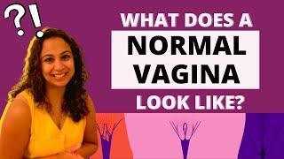 What does a NORMAL vagina look like? | Answers Dr. Niveditha Manokaran