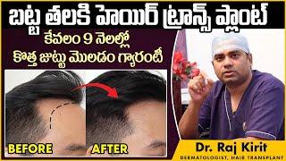 బట్టతలకు చెక్ || Hair Transplant Treatment Process || Dr Raj Kirit || Celestee Skin And Hair Clinic