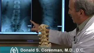 How to Read X-rays of the Lumbar Spine (Lower Back) | Spine Surgeon Colorado