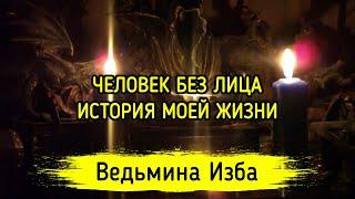 ЧЕЛОВЕК БЕЗ ЛИЦА. ИСТОРИЯ МОЕЙ ЖИЗНИ. ВЕДЬМИНА ИЗБА ▶️ ИНГА ХОСРОЕВА