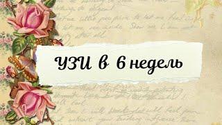 Беременность 6 недель | УЗИ | Плодное яйцо без эмбриона